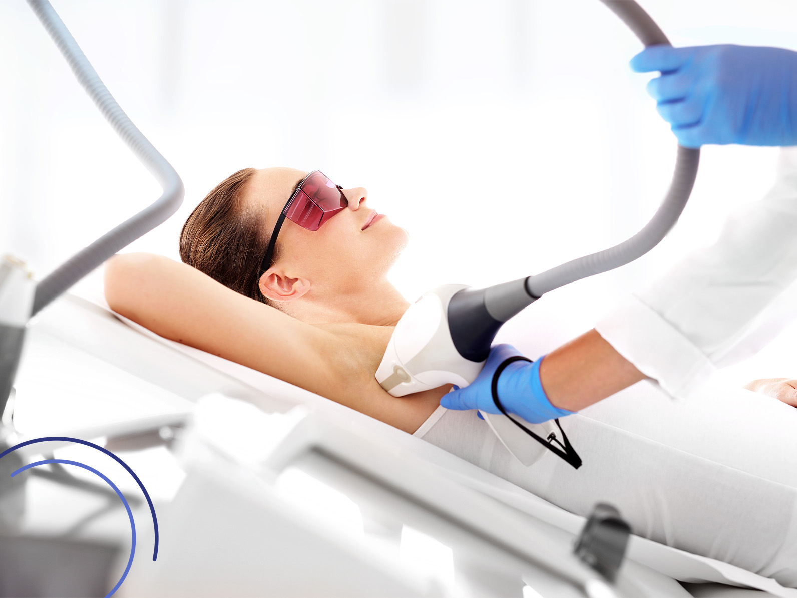 What is Laser Epilation ?